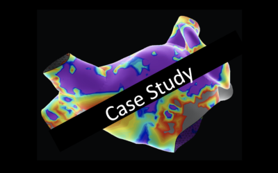 SVT Case Study