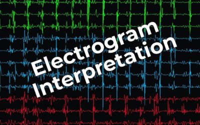 Electrogram Interpretation – 9