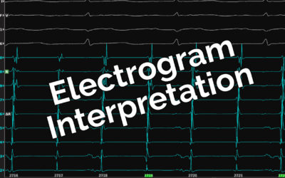 Electrogram Interpretation – 10
