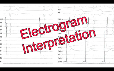 Electrogram Interpretation – 12