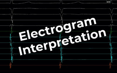 Electrogram Interpretation – 11