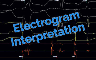 Electrogram Interpretation – 17