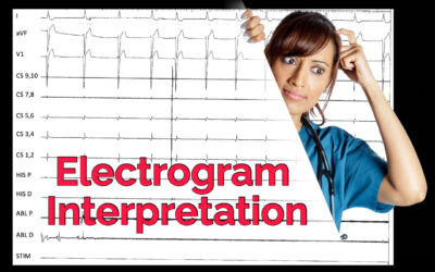 Electrogram Interpretation – 18