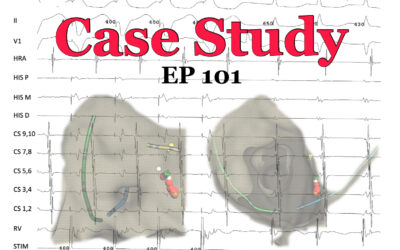 SVT Case Study – #2