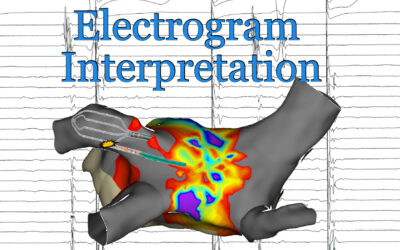 Electrogram Interpretation – 19