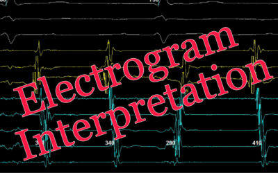 Electrogram Interpretation – 21