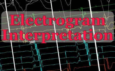 Electrogram Interpretation – 22