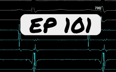 EP 101 – Signals & Catheter Positioning