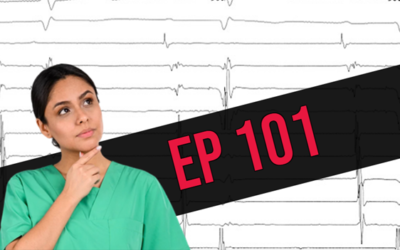 EP 101 – More Signals & Catheters