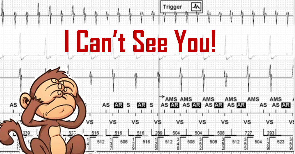 I Can’t See You!