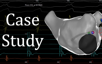 SVT Case Study – #4