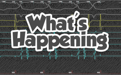 EGM Interpretation – 27