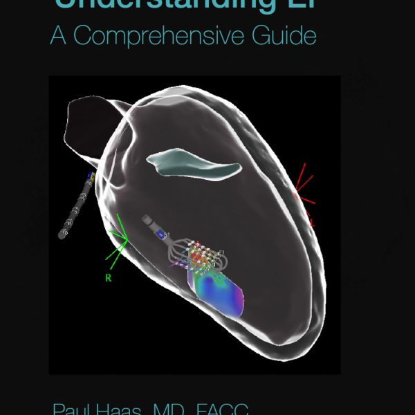 Understanding EP: A Comprehensive Guide + Workbook